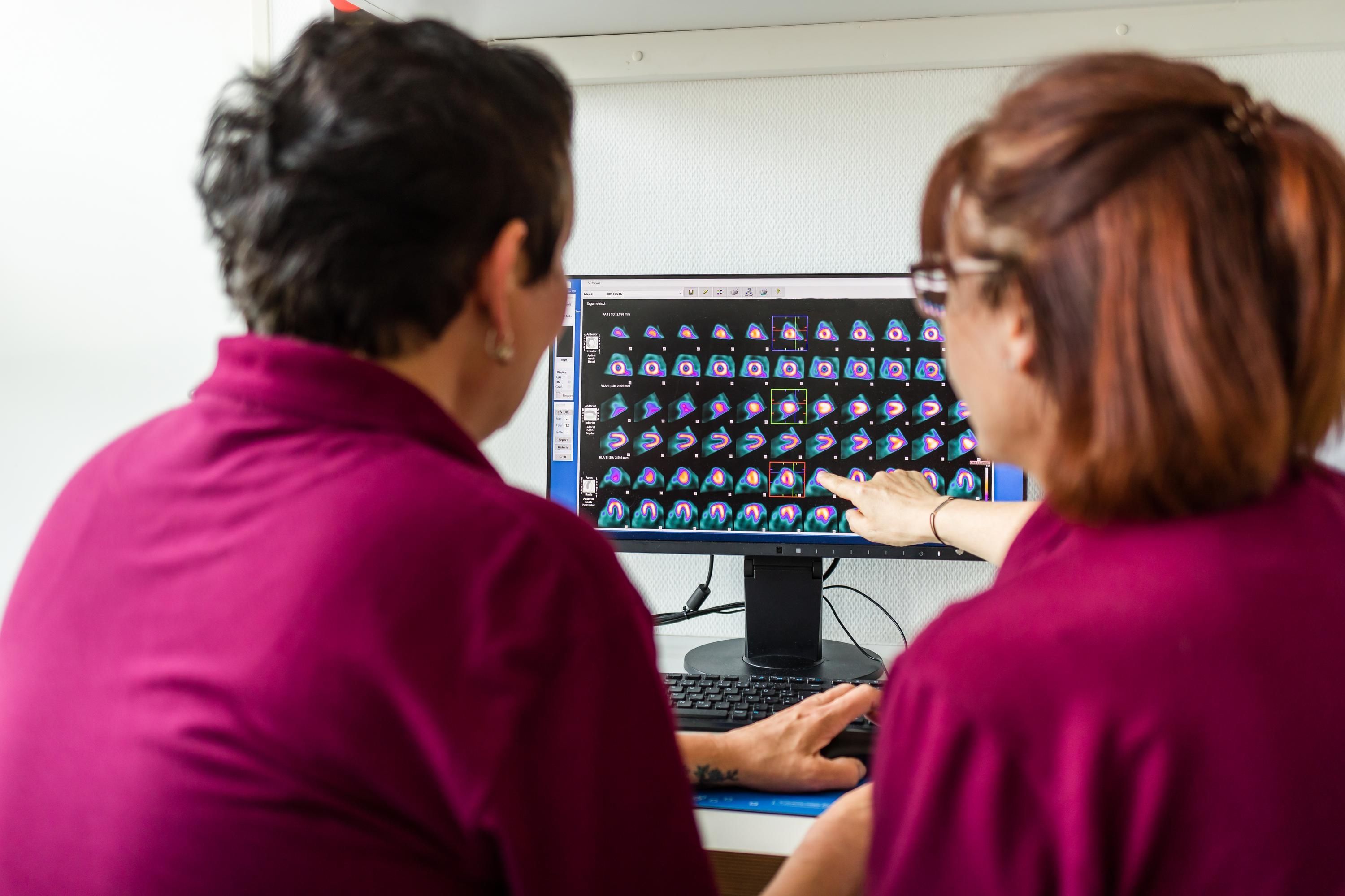 Myokardzintigraphie in Frankfurt in der Radiologie Adickesallee